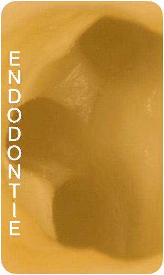 Endodontie