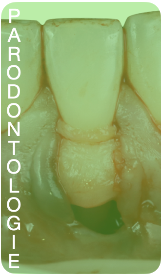 Parodontologie