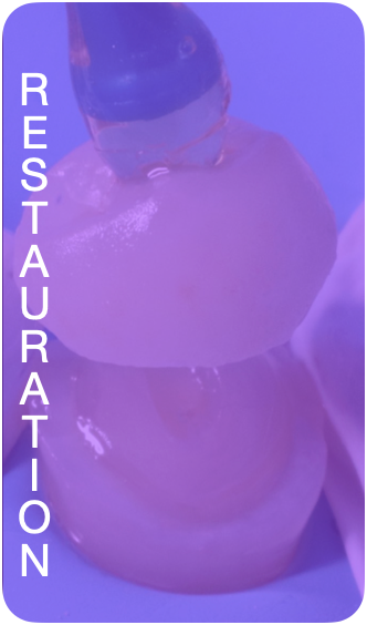 Restauration